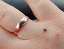 Клещи гибнут молниеносно: копеечное средство защищает лучше всех магазинных аэрозолей