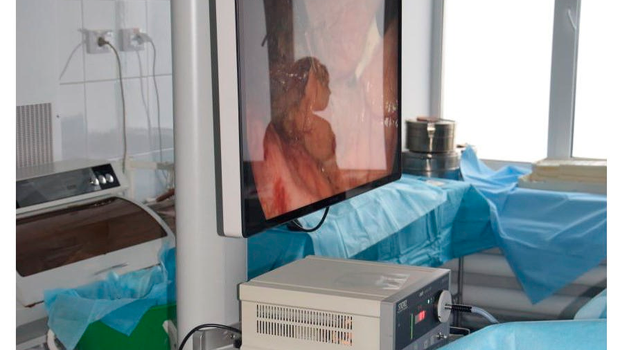 Главная картинка новости: Новая система видеоэндоскопии помогает пациентам республиканской больницы