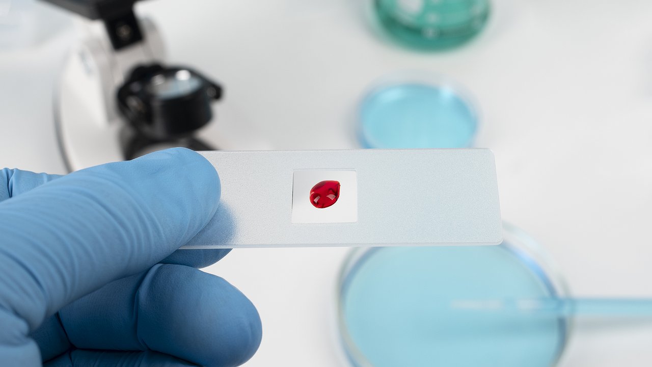 Главная картинка новости: В Чувашии выделят 1,2 млн рублей на закупку тестов на ВИЧ и гепатит